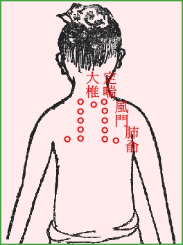 三伏貼